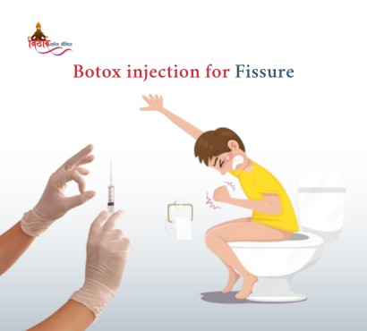 Botox Injection for Anal Fissure – A Modern Non‑Surgical Option