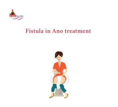 fistula-in-ano-treatment