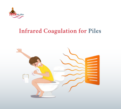 Infrared Coagulation – The Specialised Treatment for Proctology Problems