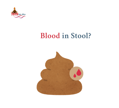 Blood in Stool: 6 Piles Signs You Shouldn’t Ignore